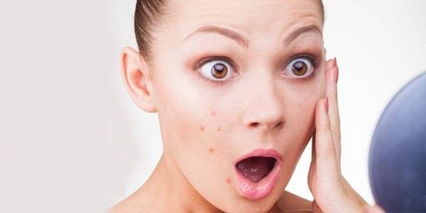 Best Acne Face Wash Treatment for You